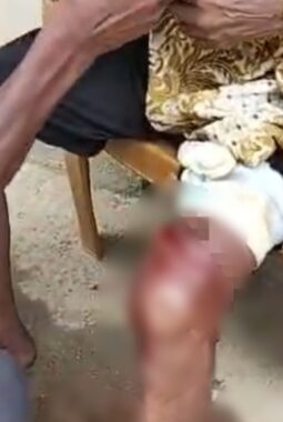 Lawan Buaya! Kakek 74 Tahun di Mubar Selamat Usai Tusuk Mata Sang Predator