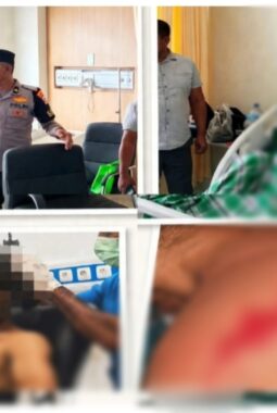 Digigit Buaya 3 Meter Saat Manah Ikan! Nelayan Kulisusu Dilarikan ke RSUD Butur